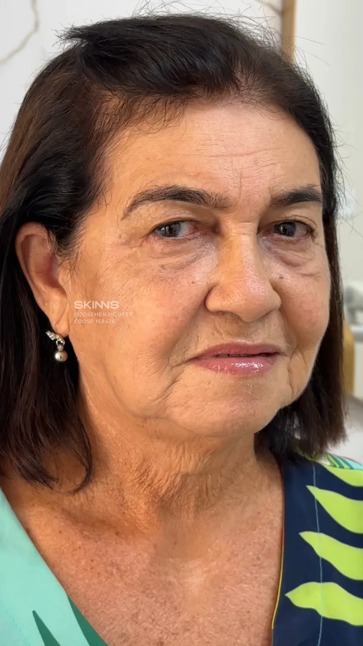 Depois — Skims Rejuvenescimento